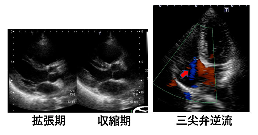 心臓超音波検査